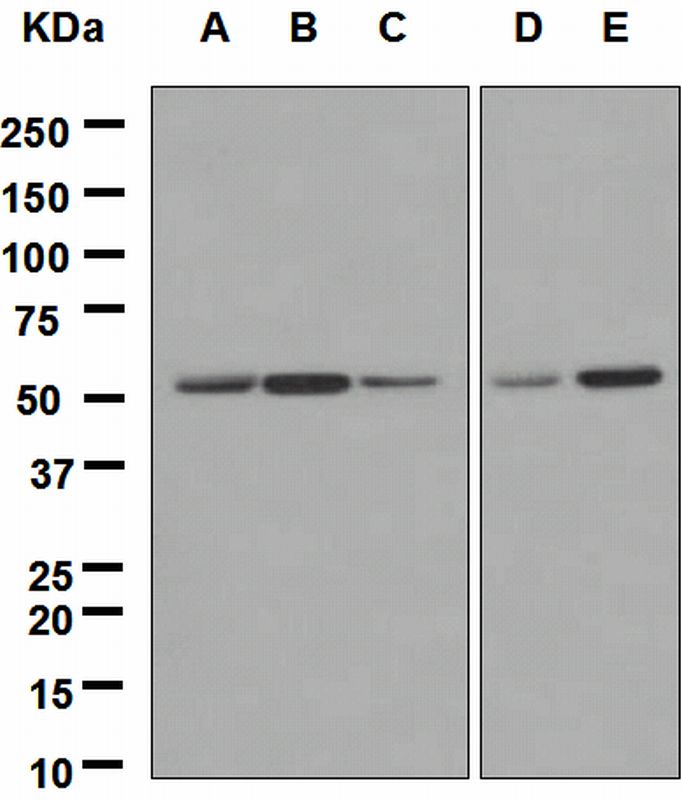 Western blot analysis on (A) mouse brain, (B) mouse heart, (C) mouse kidney, (D) rat brain, and (E) rat heart lysates using anti-ING3 antibody.