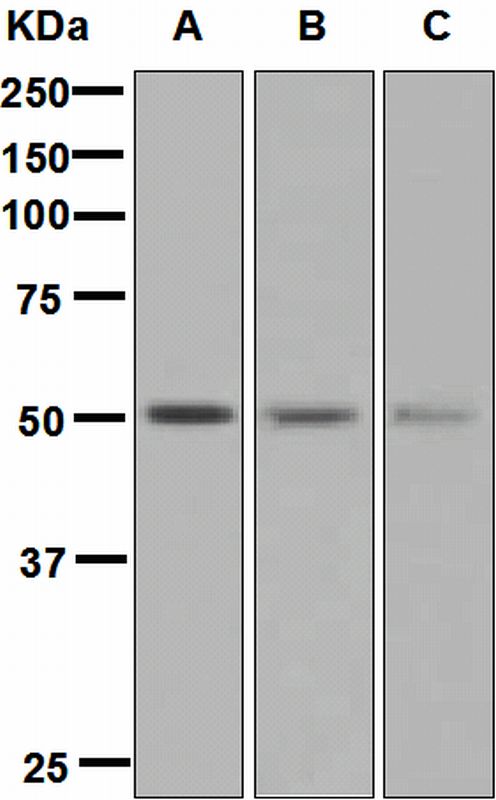 Western blot analysis on (A) fetal brain, (B) human heart, and (C) fetal kidney lysates using anti-ING3 antibody.