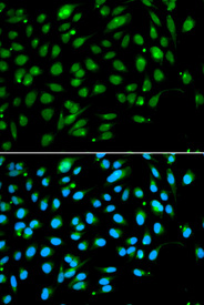Immunofluorescence analysis of A549 cell using ING3 antibody. Blue: DAPI for nuclear staining.