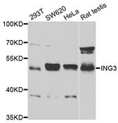 Western blot analysis of extracts of various cell lines, using ING3 antibody.