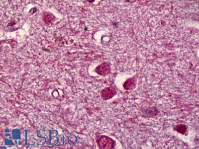 Anti-ING3 antibody IHC of human brain, cortex. Immunohistochemistry of formalin-fixed, paraffin-embedded tissue after heat-induced antigen retrieval. Antibody LS-B6402 concentration 5 ug/ml.