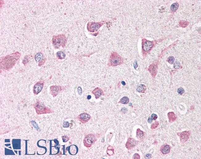 Anti-ING3 antibody IHC of human brain, cortex. Immunohistochemistry of formalin-fixed, paraffin-embedded tissue after heat-induced antigen retrieval. Antibody LS-B385 concentration 5 ug/ml.