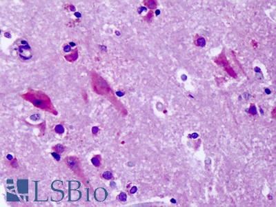 Anti-GPR83 antibody IHC of human brain, cortex, neurons. Immunohistochemistry of formalin-fixed, paraffin-embedded tissue after heat-induced antigen retrieval. Antibody LS-A1606 dilution 14-28 ug/ml.
