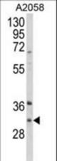 Western blot of ING5 Antibody in A2058 cell line lysates (35 ug/lane). ING5 (arrow) was detected using the purified antibody.
