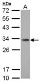 ING5 antibody [N2C1], Internal detects ING5 protein by Western blot analysis. A. 30 ug Jurkat whole cell lysate/extract. 12 % SDS-PAGE. ING5 antibody [N2C1], Internal dilution:1:1000