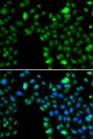 Immunofluorescence blot of MCF7 cell using ING5 antibody. Blue: DAPI for nuclear staining.