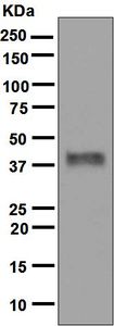 Western blot analysis on 1 ng of human INHBA recombinant protein using anti-Inhibin beta A antibody. Note: The molecular weight using recombinant protein is 43 kDa and 47 kDa for cell lines.