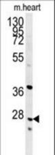 INMT Antibody western blot of mouse heart tissue lysates (35 ug/lane). The INMT antibody detected INMT protein (arrow).