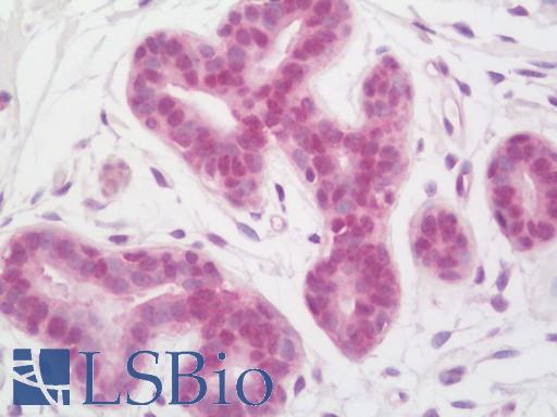 Anti-INO80 antibody IHC staining of human breast. Immunohistochemistry of formalin-fixed, paraffin-embedded tissue after heat-induced antigen retrieval. Antibody LS-B11393 concentration 5 ug/ml.