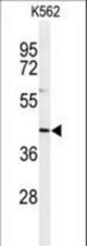 Western blot of IN80B Antibody in K562 cell line lysates (35 ug/lane). IN80B (arrow) was detected using the purified antibody.
