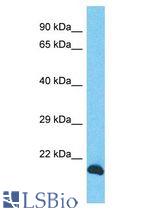 INO80C antibody Western Blot of PANC1. Antibody dilution: 1 ug/ml.