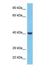 Western blot of INPP Antibody with human MCF7 Whole Cell lysate.