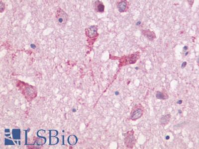 Anti-GPR83 antibody LS-A1607 IHC of human brain, neurons and neuropil. Immunohistochemistry of formalin-fixed, paraffin-embedded tissue after heat-induced antigen retrieval.