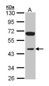 Sample (30 ug of whole cell lysate). A: Raji. 10% SDS PAGE. INPP1 antibody diluted at 1:1000