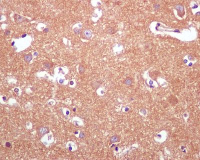 IHC of paraffin-embedded human brain tissue using anti-INPP4A antibody.