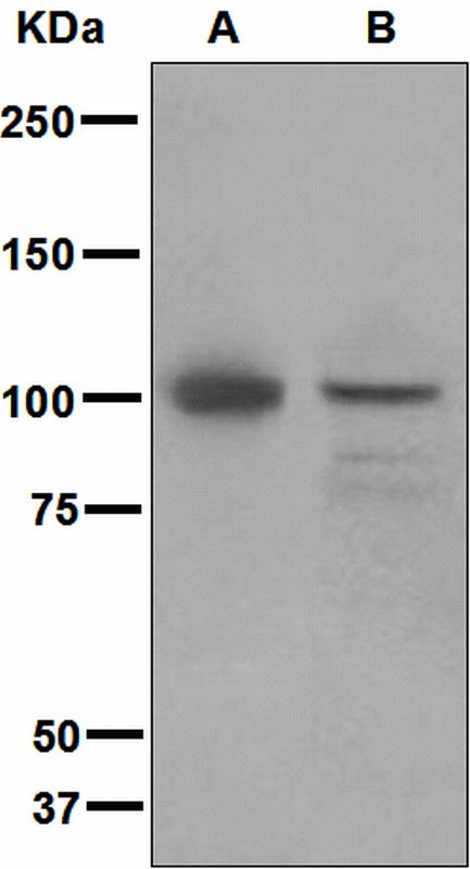Western blot analysis on (A) fetal brain and (B) Jurkat cell lysates using anti-INPP4A antibody.