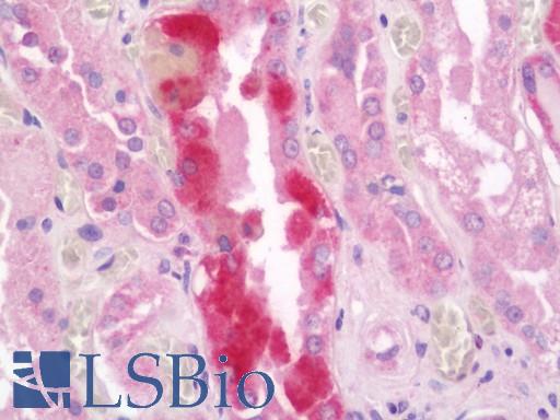 Human Kidney: Formalin-Fixed, Paraffin-Embedded (FFPE)