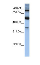 Hela cell lysate. Antibody concentration: 1.0 ug/ml. Gel concentration: 12%.