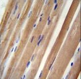 INPP5B antibody immunohistochemistry of formalin-fixed and paraffin-embedded human skeletal muscle followed by peroxidase-conjugated secondary antibody and DAB staining.