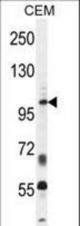 INPP5B Antibody western blot of CEM cell line lysates (35 ug/lane). The INPP5B antibody detected the INPP5B protein (arrow).