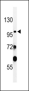 Western blot of SAC2 Antibody in WiDr cell line lysates (35 ug/lane). SAC2 (arrow) was detected using the purified antibody.