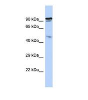 Western blot of Human HepG2. INPP5J antibody dilution 1.0 ug/ml.