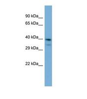 Western blot of Human Jurkat. INPP5J antibody dilution 1.0 ug/ml.