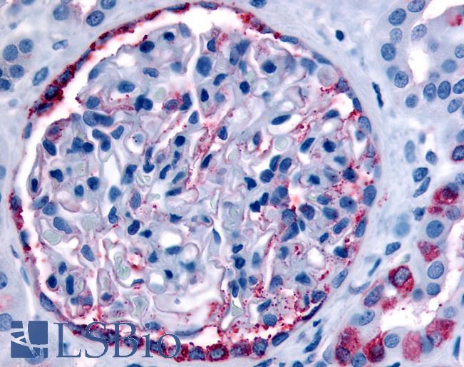 Anti-INPP5J / PIB5PA antibody LS-A3064 IHC of human glomerulus and renal tubular epithelium in cortex. Immunohistochemistry of formalin-fixed, paraffin-embedded tissue after heat-induced antigen retrieval.