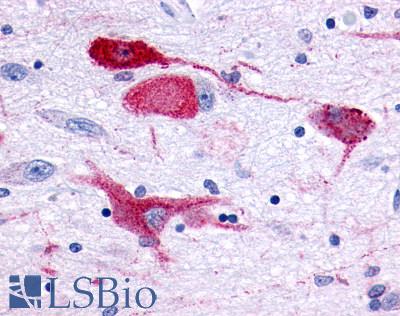 Anti-GPR83 antibody LS-A4957 IHC of human brain, neurons and glia. Immunohistochemistry of formalin-fixed, paraffin-embedded tissue after heat-induced antigen retrieval.