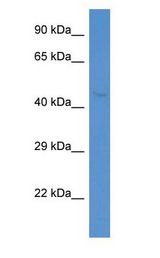 INPP5K / SKIP antibody Western Blot of MCF7.