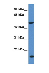 INPP5K / SKIP antibody LS-C135932 Western blot of Fetal Liver lysate. Antibody concentration 1 ug/ml.