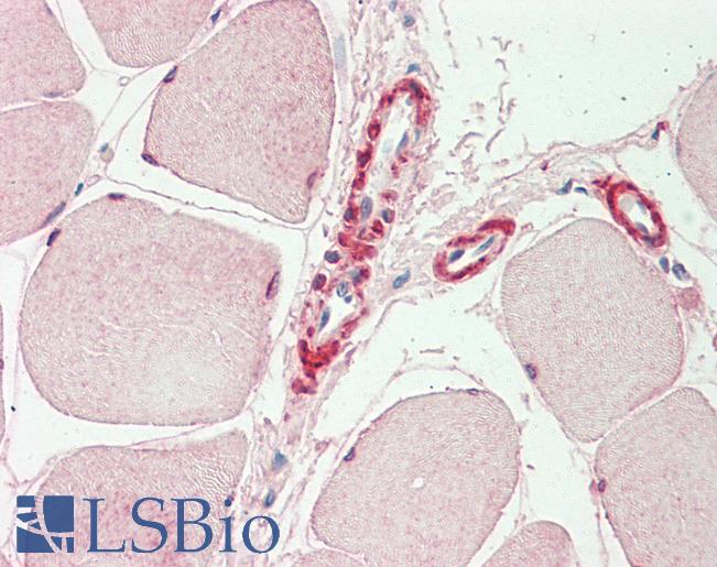 Anti-INPP5K / SKIP antibody IHC staining of human skeletal muscle. Immunohistochemistry of formalin-fixed, paraffin-embedded tissue after heat-induced antigen retrieval. Antibody LS-B10239 concentration 10 ug/ml.