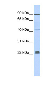 INSIG1 antibody LS-C101825 Western blot of Fetal Muscle lysate.