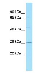 GPR84 antibody Western Blot of Placenta.