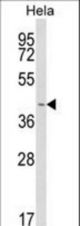Western blot of INSIG1 Antibody in HeLa cell line lysates (35 ug/lane). INSIG1 (arrow) was detected using the purified antibody.