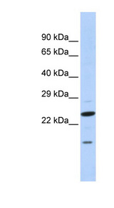 INSIG2 antibody LS-C101824 Western blot of Fetal Brain lysate.
