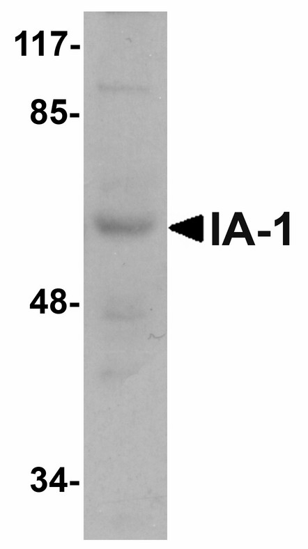 Western blot of IA-1 in rat thymus tissue lysate with IA-1 antibody at 1 ug/ml.