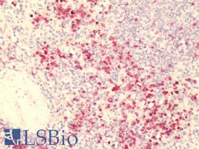 Human, Spleen: Formalin-Fixed Paraffin-Embedded (FFPE)