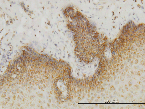 Immunoperoxidase of monoclonal antibody to INSRR on formalin-fixed paraffin-embedded human esophagus. [antibody concentration 1 ug/ml]