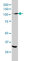 INSRR monoclonal antibody (M01), clone 6E6 Western blot of INSRR expression in HeLa.