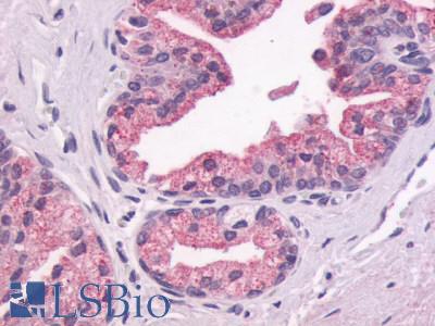Anti-GPR87 antibody LS-A1580 IHC of human prostate, epithelium. Immunohistochemistry of formalin-fixed, paraffin-embedded tissue after heat-induced antigen retrieval.