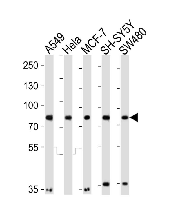 Western blot of lysates from A549, HeLa, MCF-7, SH-SY5Y, SW480 cell line (from left to right) with INSRR Antibody. Antibody was diluted at 1:1000 at each lane. A goat anti-rabbit IgG H&L (HRP) at 1:10000 dilution was used as the secondary antibody. Lysates at 20 ug per lane.