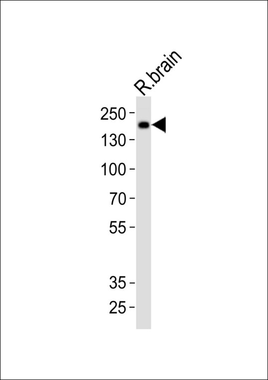 Western blot of lysate from rat brain tissue with Mouse Insrr Antibody. Antibody was diluted at 1:1000. A goat anti-rabbit IgG H&L (HRP) at 1:10000 dilution was used as the secondary antibody. Lysate at 20 ug.