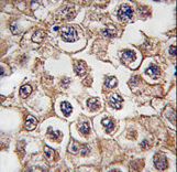 Formalin-fixed and paraffin-embedded human testis tissue reacted with INSRR antibody , which was peroxidase-conjugated to the secondary antibody, followed by DAB staining. This data demonstrates the use of this antibody for immunohistochemistry; clinical relevance has not been evaluated.