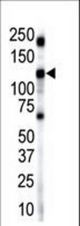 Western blot of anti-INSRR antibody in mouse brain lysate. INSRR (arrow) was detected using purified antibody. Secondary HRP-anti-rabbit was used for signal visualization with chemiluminescence.