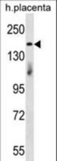 INTS1 Antibody western blot of human placenta tissue lysates (35 ug/lane). The INTS1 antibody detected the INTS1 protein (arrow).
