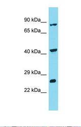Western blot of Human ACHN. INTS10 antibody dilution 1.0 ug/ml.