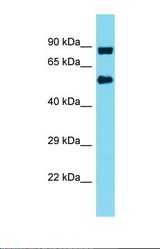 Western blot of Human MDA-MB-435S. INTS10 antibody dilution 1.0 ug/ml.