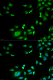 Immunofluorescence analysis of A549 cell using INTS10 antibody. Blue: DAPI for nuclear staining.