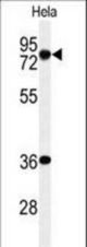 Western blot of INT10 Antibody in HeLa cell line lysates (35 ug/lane). INT10 (arrow) was detected using the purified antibody.